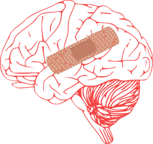 Brain Injury At Clker Vector Free Download Clipart